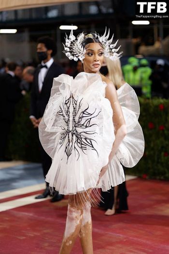 Winnie Harlow