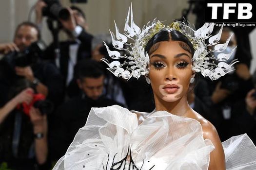 Winnie Harlow