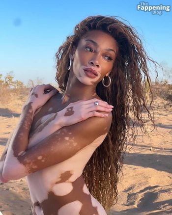 Winnie Harlow