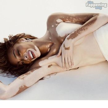 Winnie Harlow