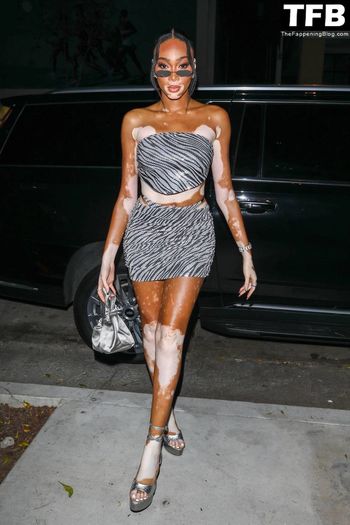 Winnie Harlow