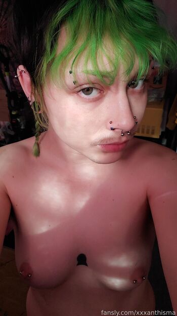 xxxanthisma